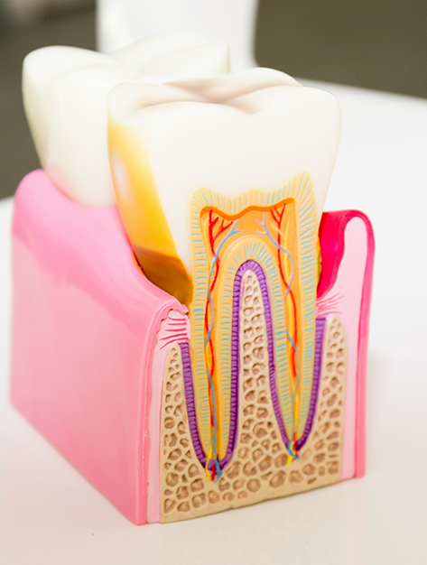 Model of a tooth showing the layers inside of it