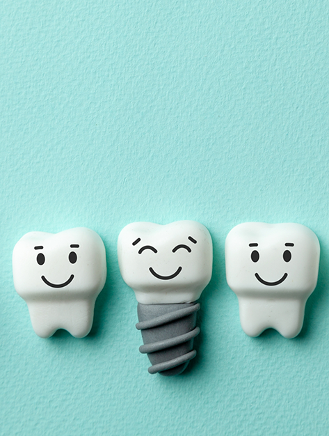 Illustration of a smiling dental implant between two smiling natural teeth