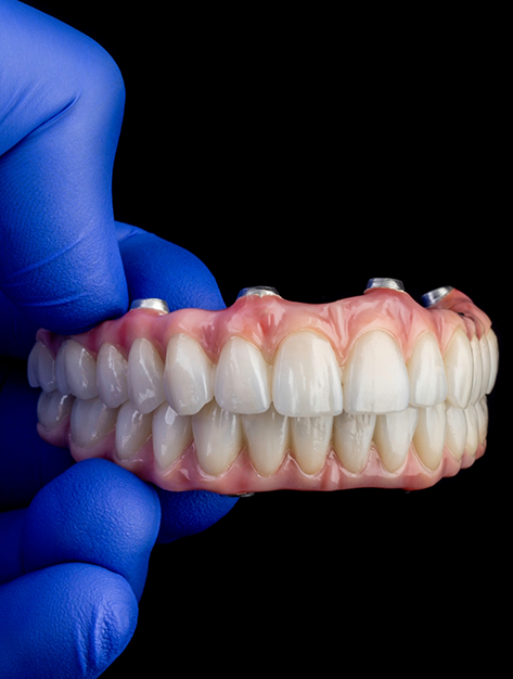 Gloved hand holding an implant denture in Houston