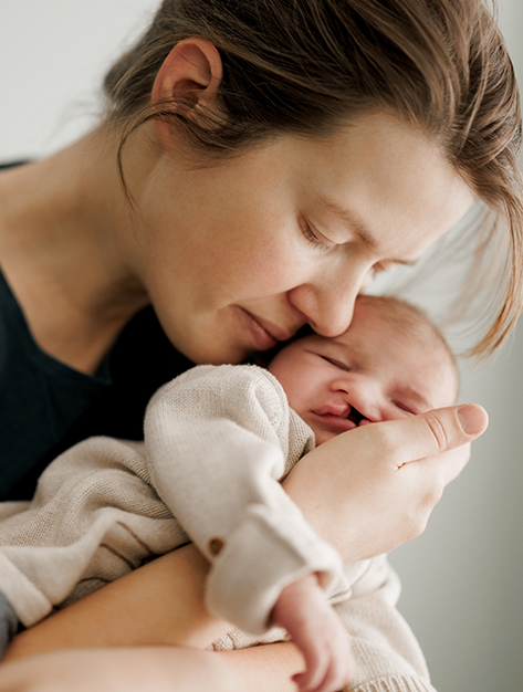 Mother holding her baby who has a cleft lip in Houston