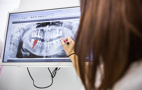 Dentist showing a patient an x ray of their teeth