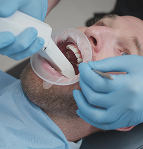Man having digital scans of his teeth taken